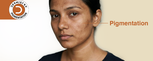 Best Face Wash for Pigmentation and Tanning