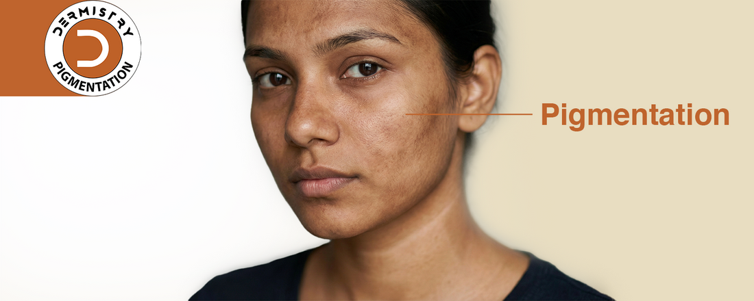 Best Face Wash for Pigmentation and Tanning