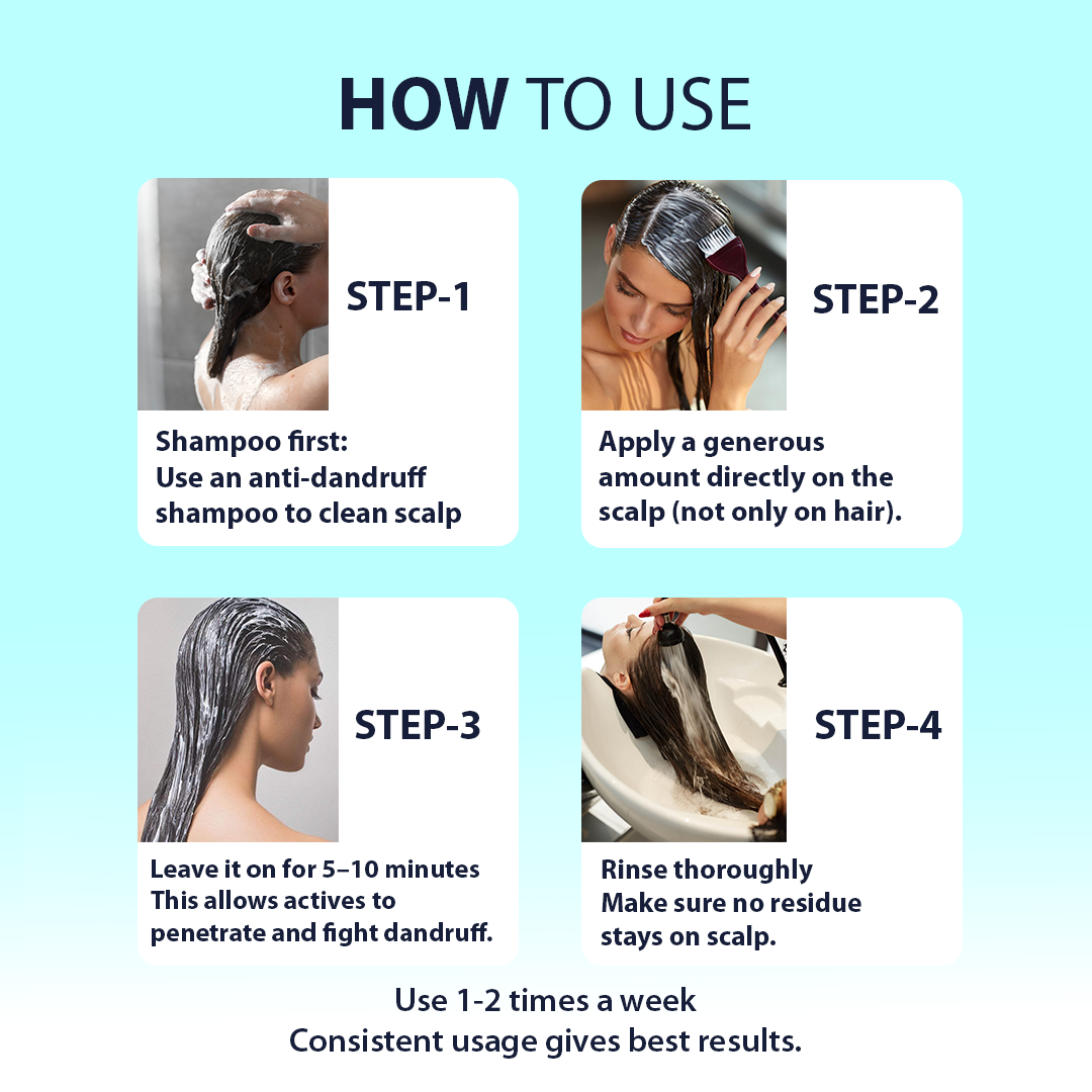 Anti dandruff hair mask scalp care