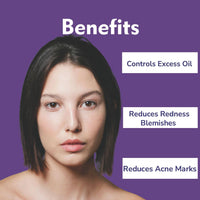 Face serum for acne control