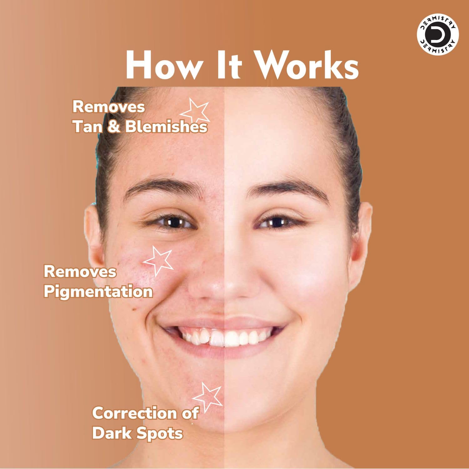 Hyperpigmentation solution before after