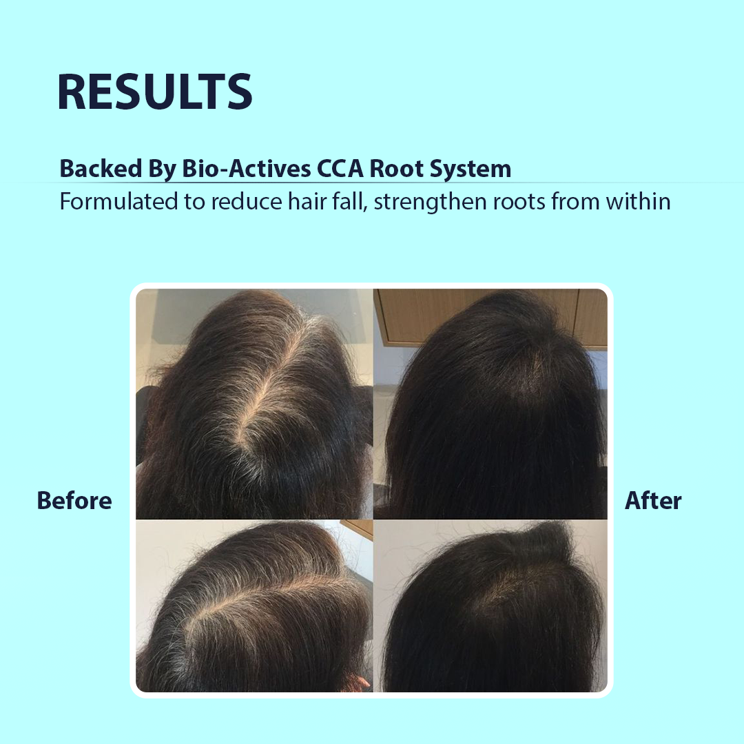 Strong roots treatment shampoo