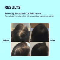 Strong roots treatment shampoo