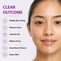 Dermistry 1% Salicylic Acid Back Acne Open Pores Excess Oil Removal Exfoliating Body Wash & 5% Niacinamide Spot Corrector Face Serum