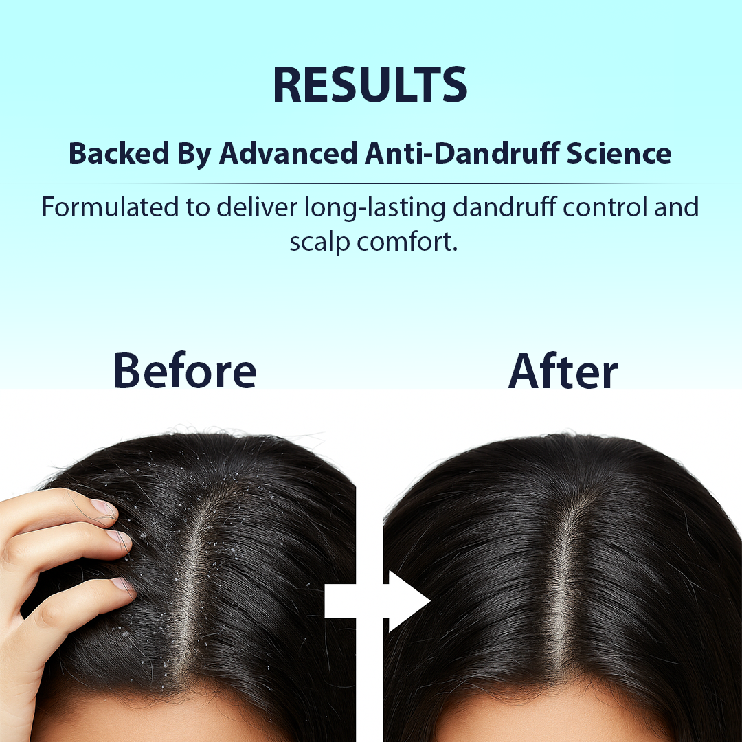 Before and after comparison of dandruff control with text about advanced anti-dandruff science.